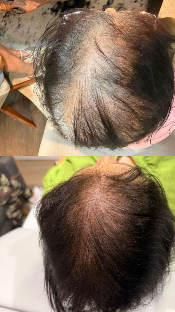 hair-1