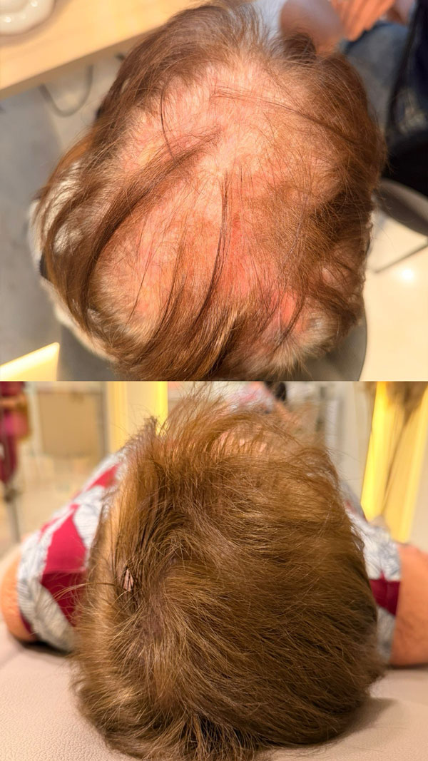 hair-2