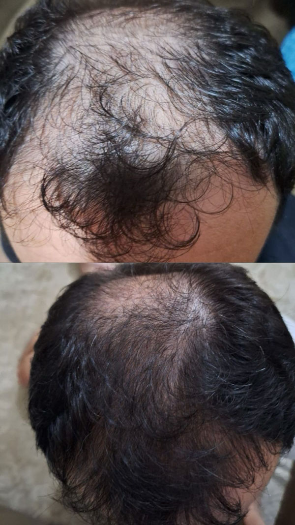 hair-3