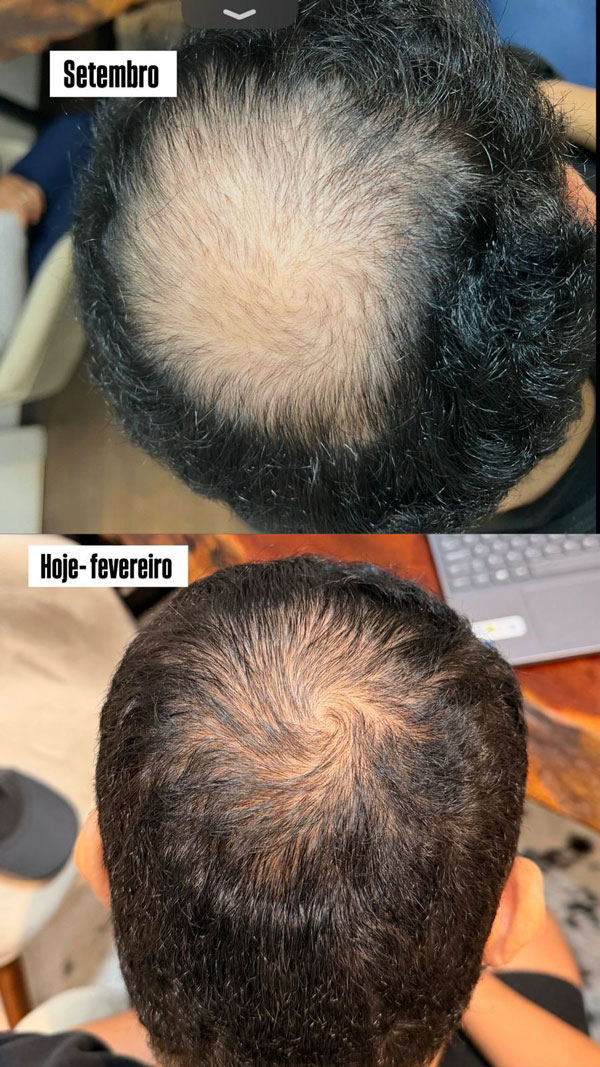 hair-4