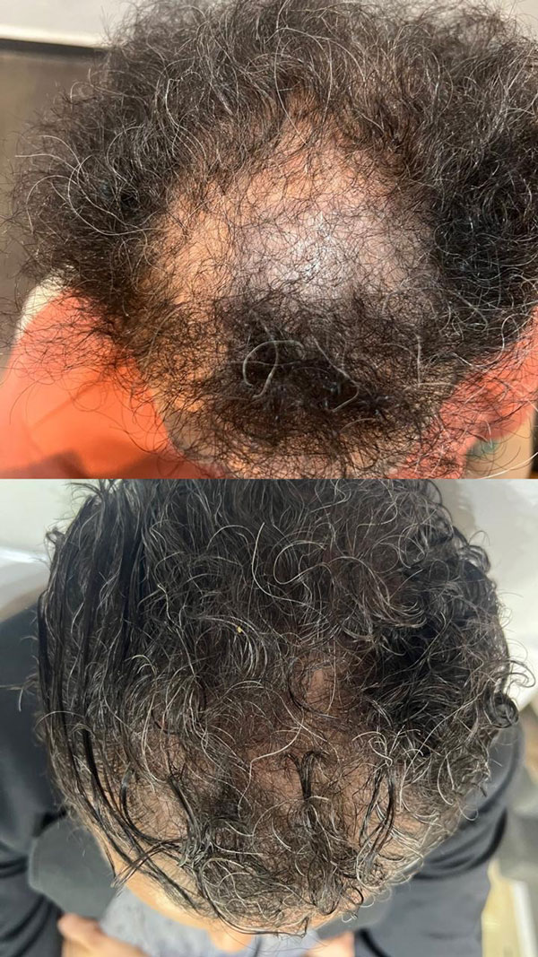 hair-5